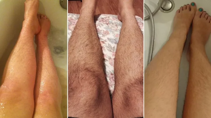 Women Unshaved Legs