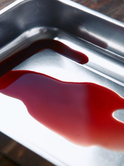 Bloody Stool After Alcohol